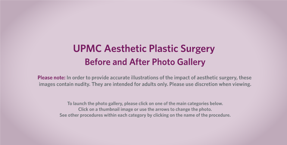Abdominoplasty Photo Gallery
