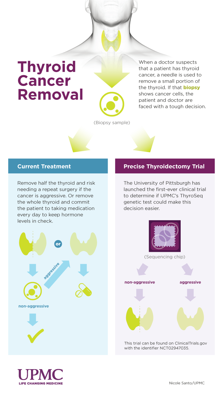 Cancer Test to Offer Safe ThyroidPreserving Surgery