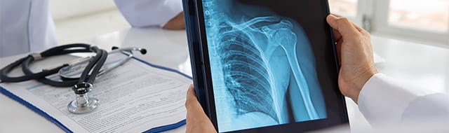 Doctor reviewing an x-ray.