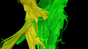 Loss of fibers image
