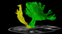 Brain fibers image