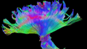 Brain fibers imaging