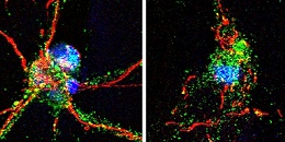 neurites intact broken ischemia release