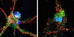 neurites intact broken ischemia release