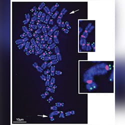 Opresko Stuck Chromatids release