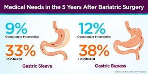 Gastric Bypass Vs Sleeve infogr release