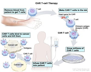 CAR T Courtesy NCI release