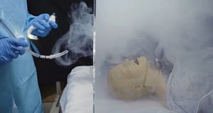 passive intubation box release