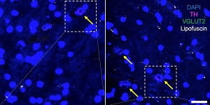 freyberg figure release
