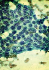 Endocrine Research & Clinical Trials