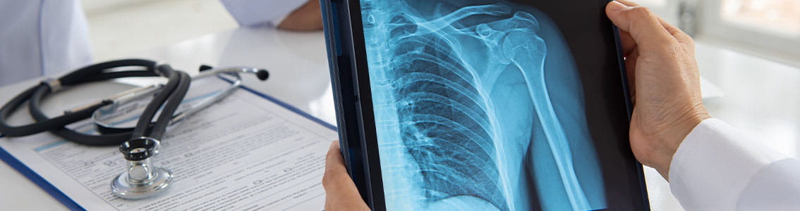 Doctor holding X-Ray of shoulder.