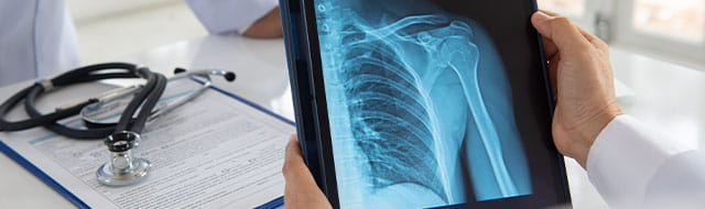 Doctor holding X-Ray of shoulder.