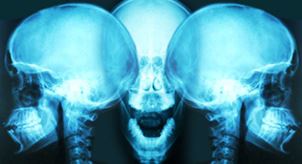 Regenerative Facial Reconstruction Treatment at the McGowan Institute