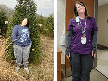 Karen Bright before and after surgery.