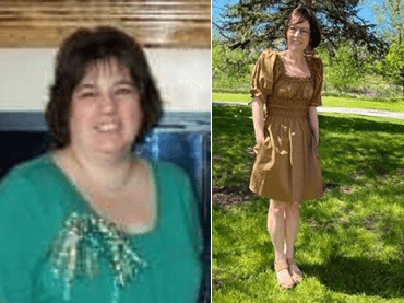 Read Kristen's bariatrics story.
